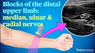 Ultrasound guided blocks of the median ulnar and radial nerves [upl. by Gelasias]