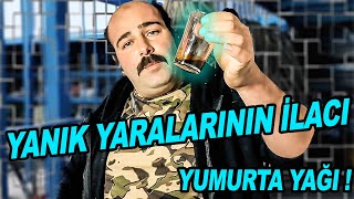 KAYNAK YANIK YARALARI VE HER TÜRLÜ YARANIN İLACI YUMURTA YAĞI  YUMURTA YAĞI NASIL YAPILIR [upl. by Neal]