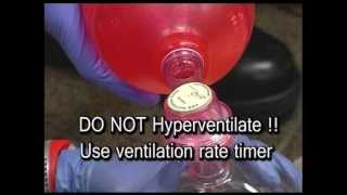 EPIC Training Clip showing BVM with Ventilation Rate Timer [upl. by Karalee417]