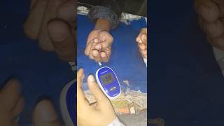 Blood Sugar Test shorts trending shortvideo [upl. by Ariait]