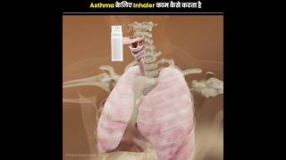 How does Inhaler Work for Asthma [upl. by Annodal]