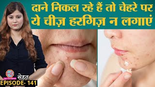 Acne Pimples दानों को बिना निशान ठीक करना है तो ये गलतियां ना करें  Sehat ep 141 [upl. by Pammy657]