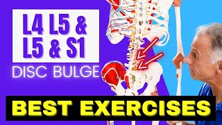 L4 L5 amp L5 S1 Disc Bulge Best Exercises Rehab For Relief [upl. by Kask677]