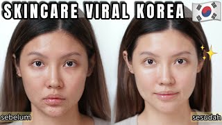 REVIEW DALBA SKINCARE VIRAL KOREA  COCOK UNTUK ACNE PRONE amp ANTI AGING [upl. by Notsud440]