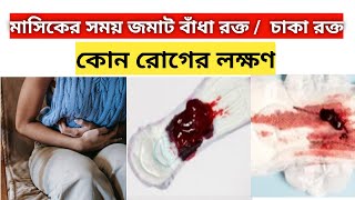 মাসিকের সময় জমাট বাঁধা রক্ত কেন বের হয়masiker somoy jomat badha rokto। rokto [upl. by O'Rourke]