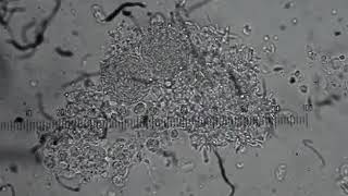 Eimeria necatrix schizonts and merozoites [upl. by Rol]