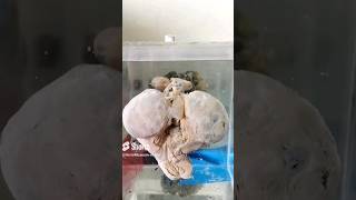 Uterus with fetus specimrn mounting video😨👍🏻baby fetus babyshorts museum cutebaby uterus [upl. by Cullen]