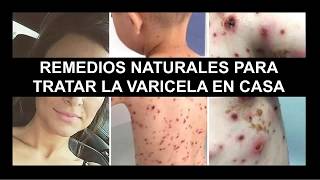 Conoce estos INCREÍBLES remedios NATURALES para tratar la VARICELA en casa [upl. by Adalheid]