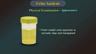 Urine Analysis [upl. by Jerome212]