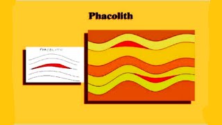 What is Phacolith in Hindi [upl. by Beitnes520]