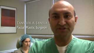 FACIAL LIPOSUCTION  DR TANVEER JANJUA  NEW JERSEY [upl. by Dermott]