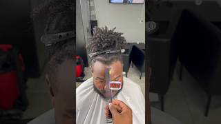 RECEDING HAIRLINE FIX😱😭 hairline lineup haircut transformation barber barbershop [upl. by Dow]