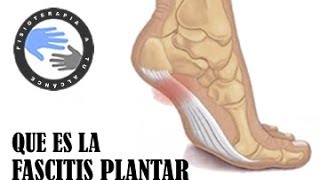 Fascitis plantar que es y como se produce [upl. by Kcered]