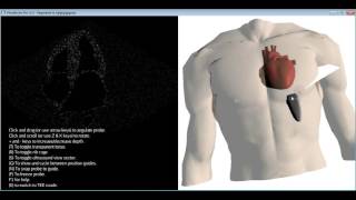 How to get the standard transthoracic echocardiography TTE views [upl. by Adniram]