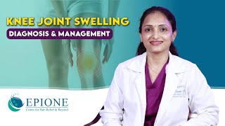 Knee Joint Swelling  Diagnosis And Management  Dr Chetana Chetan  Epione Chennai [upl. by Blackburn95]