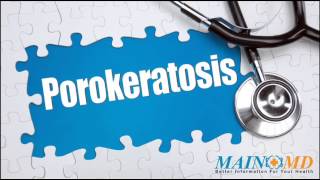 Porokeratosis ¦ Treatment and Symptoms [upl. by Yuma]