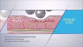 Endosphères Therapy  Pain Reduction [upl. by Strader]