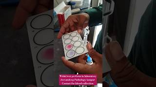 Widal test perform in laboratory by Slide method CBC widal malaria tests shorts viral cbc tests [upl. by Bruce]