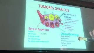 2do GINECO patologia de ovario 230924 [upl. by Hirsh]