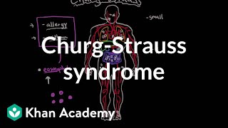 ChurgStrauss syndrome  Circulatory System and Disease  NCLEXRN  Khan Academy [upl. by Elocal793]