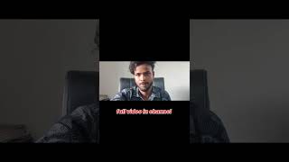 Hair transplant journey from day 01 to day 365 Best hair transplant result in india [upl. by Acassej]