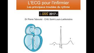 6c Les principaux troubles du rythme ECG à lusage de linfirmier Dr Taboulet [upl. by Wolsniw272]