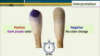 Oxidase Test Five Methods [upl. by Lalib711]