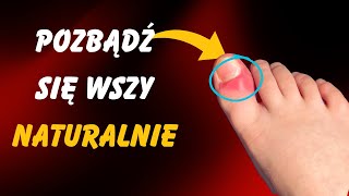 JAK TWOJE STOPY OSTRZEGAJĄ CIĘ O PROBLEMACH Z WĄTROBĄ [upl. by Nos]