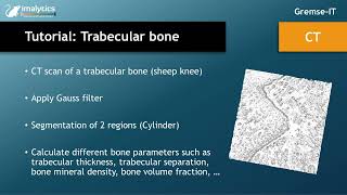 Tutorial video CT quotTrabecular bonequot [upl. by Baird]