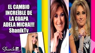 CAMBIO DE CARA DE ADELA MICHA ShanikTv [upl. by Dichy]