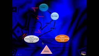 Internal Medicine Grand Rounds Sarcoidosis [upl. by Jarv599]