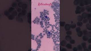 Reticulocyte 🩸🔬💉🦠🧬🧫❤️mlt bmlt dmlt youtubeshorts shorts [upl. by Anoet]