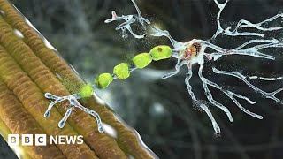 Truly remarkable drug can reverse decline caused by motor neurone disease  BBC News [upl. by Morentz]