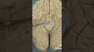 Interpeduncular fossa neuroanatomy brainstembrainWCUCOM Neuroscience [upl. by Previdi]