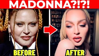 Plastic Surgeon MADONNAs Cosmetic Surgery Transformation [upl. by Atinuj]