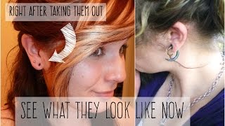 WHY I TOOK MY EAR GAUGES OUT [upl. by Devan855]