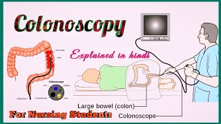 Colonoscopy in Hindi  Colonoscopy test kya hai  Nursing [upl. by Chappie11]