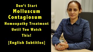 Dont Start Molluscum Contagiosum Homeopathic Treatment Until You Watch This [upl. by Ataynik104]