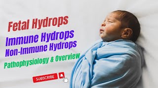 Fetal Hydrops Immune Hydrops NonImmune Hydrops Hydrops fetalis Robbins Pathology Chapter 7 [upl. by Innaig]