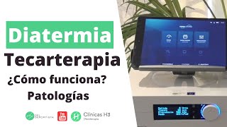 ¿Qué es la tecarterapia Patologías indicadas ✅ Diatermia Madrid Clínicas H3 [upl. by Armbrecht507]