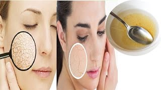 How to Get Rid of Dry Skin in Winters । Dry Skin Care Tips Cracked Skin Home Remedies [upl. by Yenahpets]