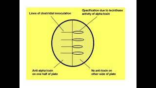 Lecithinase or Naglers Test [upl. by Tunnell835]