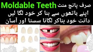 Moldable Teeth  Broken Tooth  moldable false teeth how to use  dant ka dard ka fori ilaj [upl. by Esoranna929]