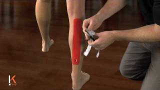 KT Tape Calf Strain II [upl. by Sucramel932]