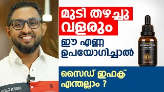 മുടി തഴച്ചു വളരും ഈ എണ്ണ ഉപയോഗിച്ചാൽ മതി  Minoxidil Side Effects  Dr varun Nambiar [upl. by Khan]