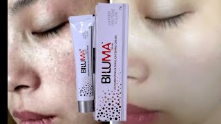 Biluma Cream  Best skin lightening cream Remove Dark spots pigmentation  Acne  pimples marks [upl. by Esiocnarf]