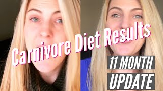 Carnivore Diet Results 11 month Update [upl. by Ihtraa139]