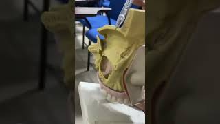 OSPE Maxillary sinus in nose model [upl. by Aelsel]