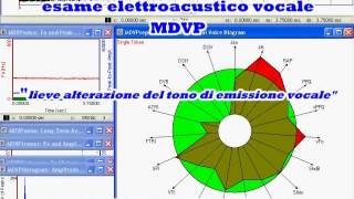 CORDECTOMIA RIABILITAZIONE [upl. by Wera607]