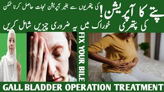 Pitte Ki Pathri Ka Asan Ilaj Gall Bladder Stones Treatment Liver Health Listen Your Body [upl. by Okim]